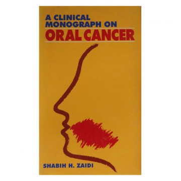 A Clinical Monograph on Oral Cancer